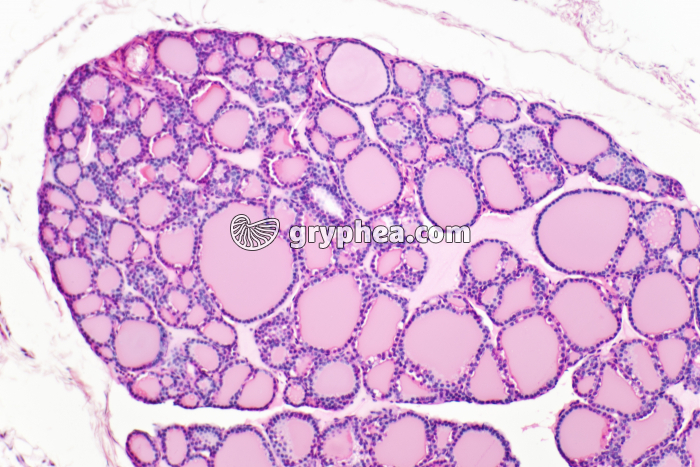 Thyroïde x25 - gryphea.org